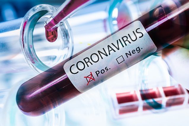Monitoraggio coronavirus - due casi in Città